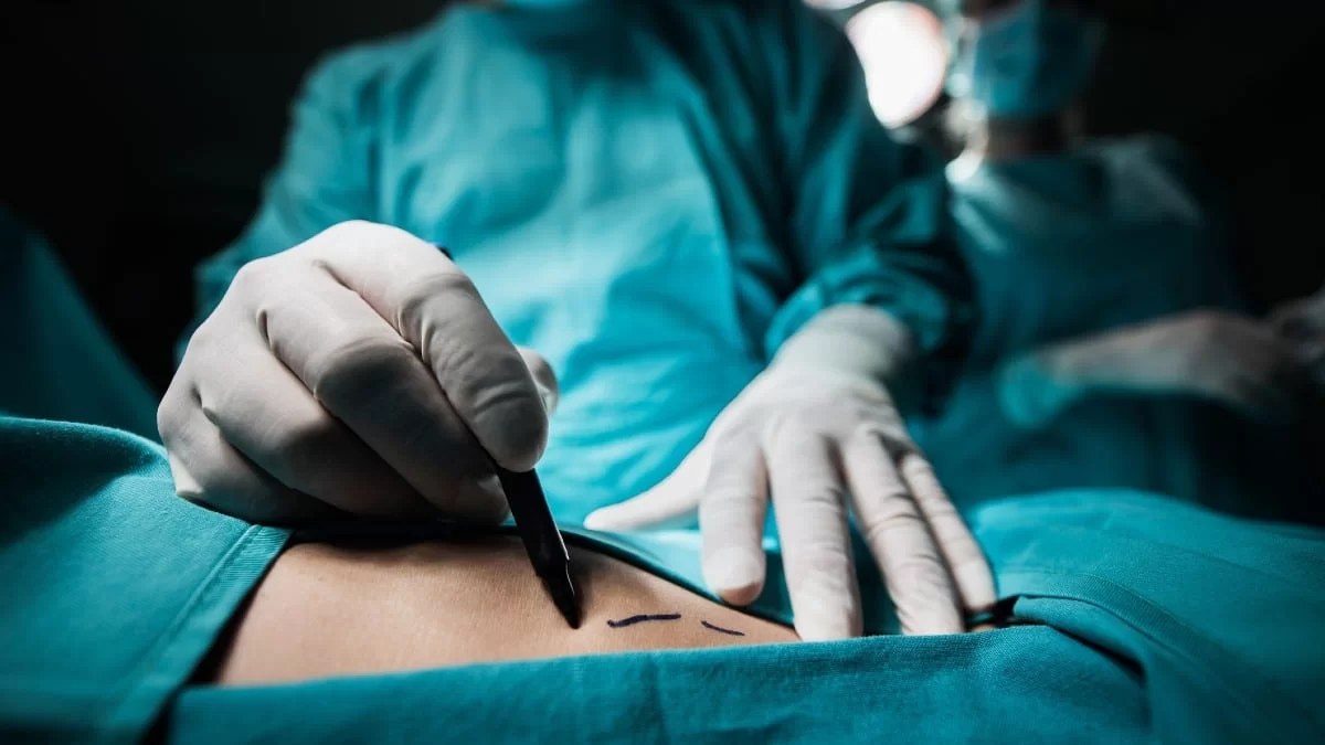 Αεροσυνοδός καταθέτει αγωγή σε γνωστό Έλληνα πλαστικό χειρουργό