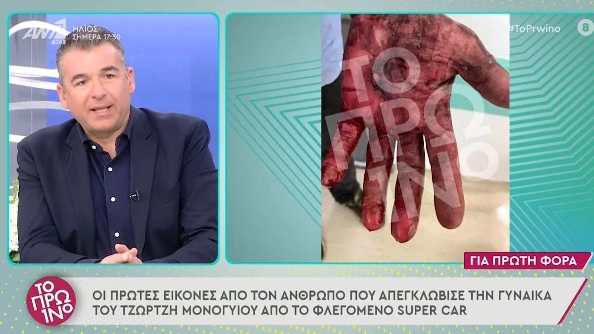 Μονογυιός: Ανατριχιαστικές οι εικόνες μέσα από το αμάξι - Οι πληγές του ανθρώπου που τους απεγκλώβισε