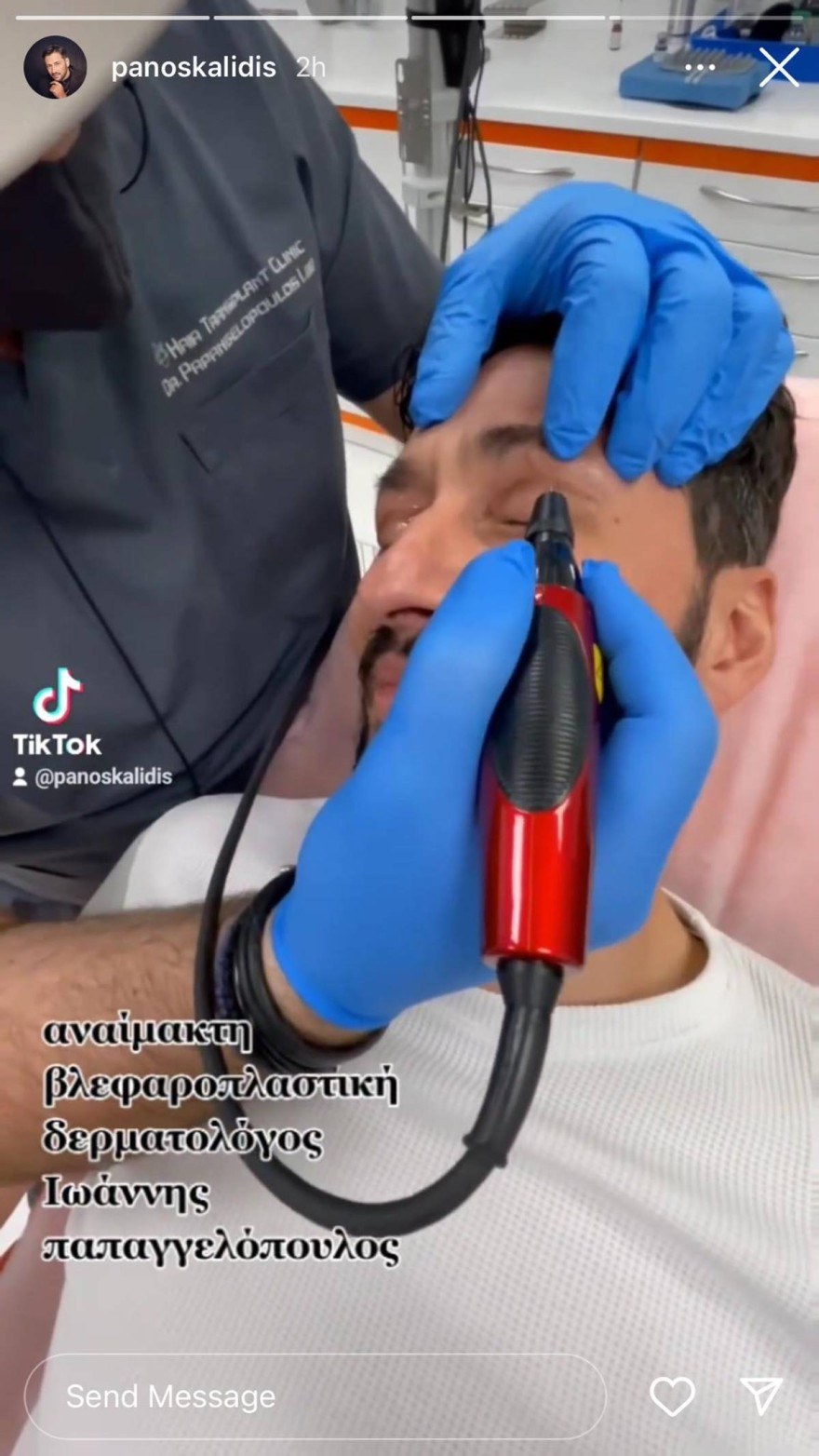 Πάνος Καλίδης πλαστική