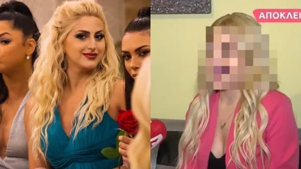 Αγνώριστη η Έλενα του The Bachelor μετά την πλαστική στη μύτη - Η νέα της εικόνα