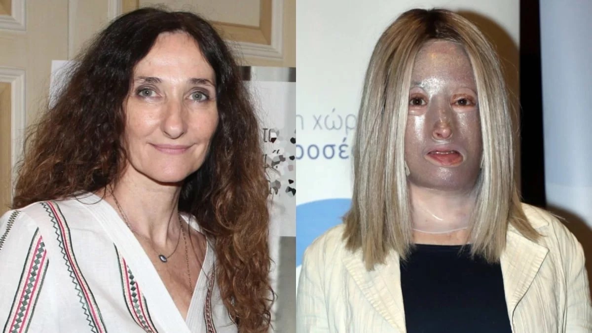 H Oλυμπία Κρασαγάκη αποκάλυψε ότι έχει καρκίνο - Το μήνυμα στήριξης της Ιωάννας Παλιοσπύρου