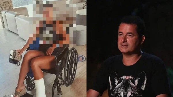 Πρώην παίκτρια του Survivor στρέφεται νομικά κατά της Acun Medya για τον σοβαρό τραυματισμό της