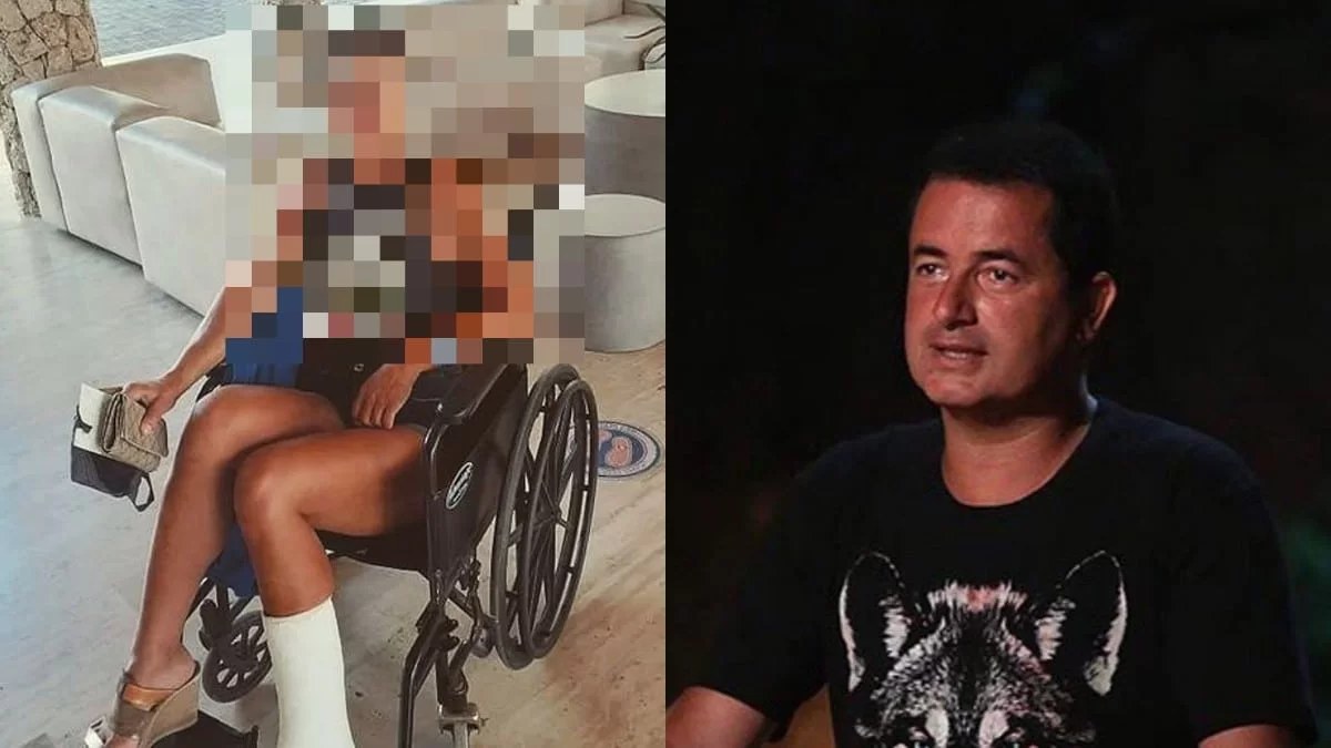 Πρώην παίκτρια του Survivor στρέφεται νομικά κατά της Acun Medya για τον σοβαρό τραυματισμό της