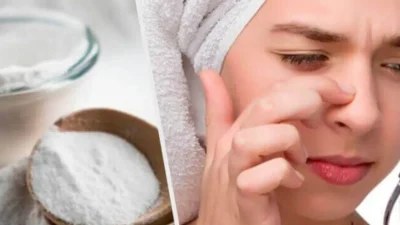 Άπλωσε μαγειρική σόδα στην μύτη σου - Κάνει θαύματα σε ένα σημαντικό πρόβλημα