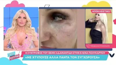«Λυπάμαι που το λέω αλλά...» - ''Καταπέλτης'' η Καινούργιου για τον ξυλοδαρμό της συντρόφου του Αδαμαντίδη