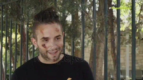 «Δεν φορούσα κράνος, νόμιζαν ότι είμαι νεκρός» - Οι πρώτες δηλώσεις του iLLEOo μετά το σοβαρό τροχαίο