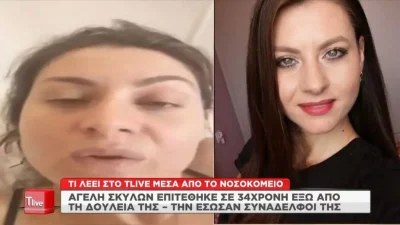 ''Μου έτρωγαν τα χέρια και τα πόδια...'' - Ανατριχιάζει η περιγραφή της γυναίκας που δέχτηκε επίθεση από σκυλιά έξω από τη δουλειά της