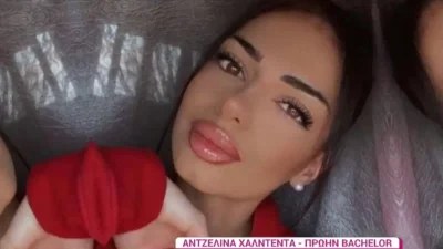 ''Το στόμα μου στράβωσε ολόκληρο...'' - Η Αντζελίνα Χαλντέντα του Bachelor αποκαλύπτει τις αισθητικές επεμβάσεις που έχει κάνει