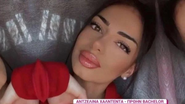''Το στόμα μου στράβωσε ολόκληρο...'' - Η Αντζελίνα Χαλντέντα του Bachelor αποκαλύπτει τις αισθητικές επεμβάσεις που έχει κάνει