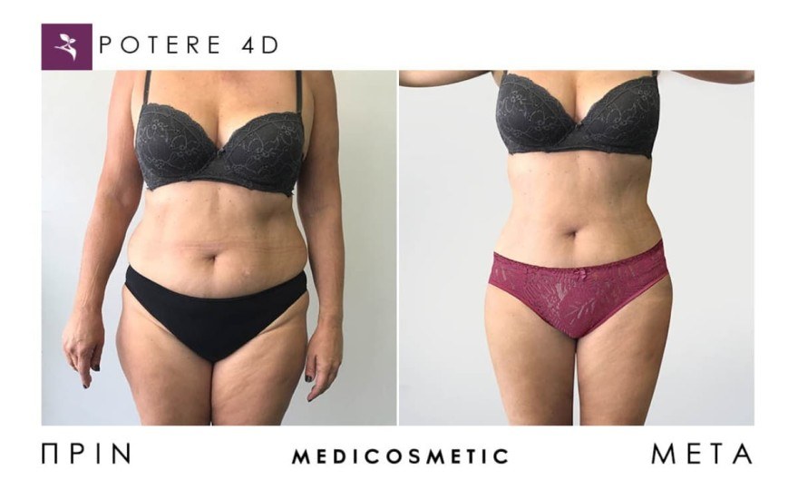 Medi Cosmetic θεραπείες