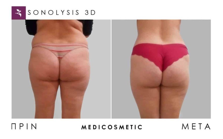 Medi Cosmetic θεραπείες
