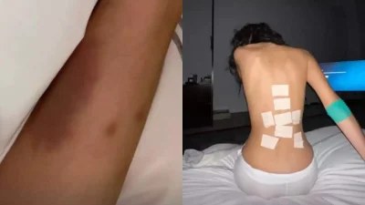 Σάλος στην showbiz: Στο νοσοκομείο με μώλωπες η...