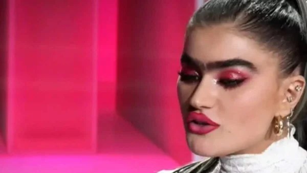 Σοφία Χατζηπαντελή: Έκανε botox και δημοσίευσε φωτογραφίες από το κρεβάτι του πλαστικού χειρούργου