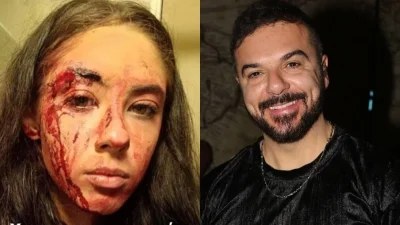 «Γλύτωσε από θαύμα τον θάνατο» - Συγκλονίζει ο Τριαντάφυλλος για τον ξυλοδαρμό της βαφτιστήρας του από τον σύντροφό της