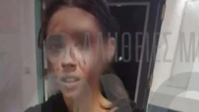 Θύμα άγριου ξυλοδαρμού από τον σύντροφό της η βαφτιστήρα του Τριαντάφυλλου