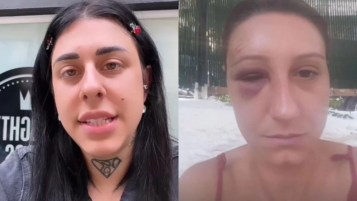 Συγκλονίζει η Super Κική: «Θα το ξανά έκανα...» - Έβγαλε στη φόρα φωτογραφίες της φίλης της με αίματα και σημάδια