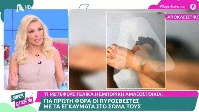Τέμπη: Ανατριχιαστικό - Φωτογραφίες από τα εγκαύματα στα σώματα των πυροσβεστών