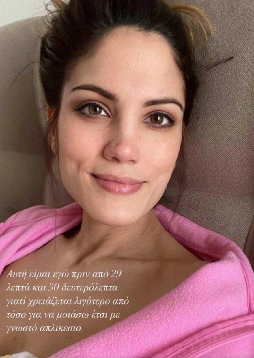 Συνατσάκη φιλτρο