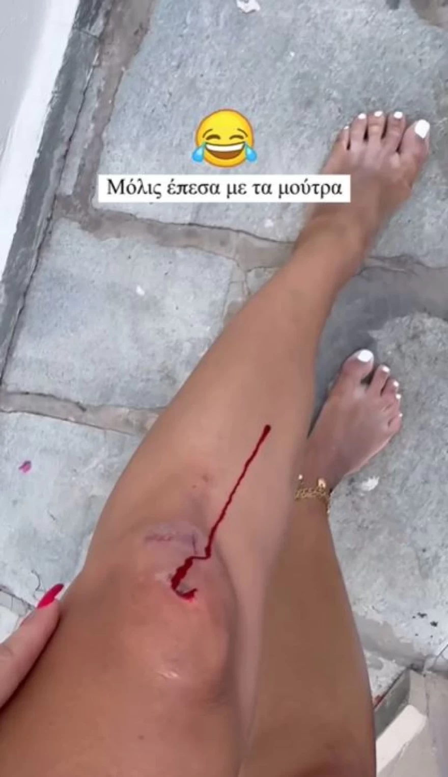 Ιωάννα Τούνη Πάρος ατύχημα