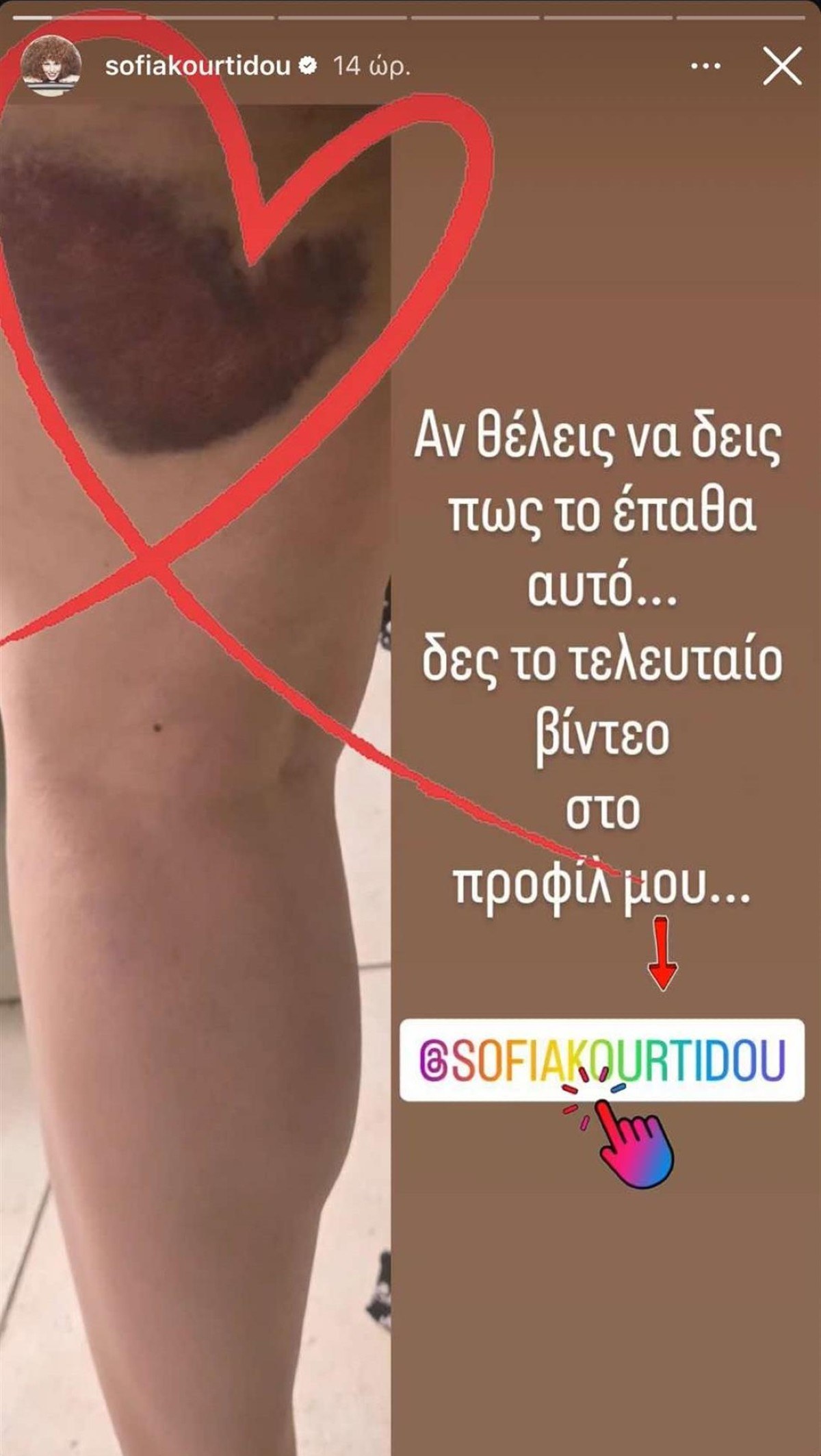 Η Μελανιά της Σοφίας Κουρτίδου από την τούμπα στη σκηνή