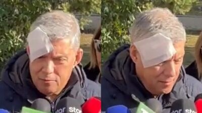 Ο Κώστας Αγοραστός χτυπημένος