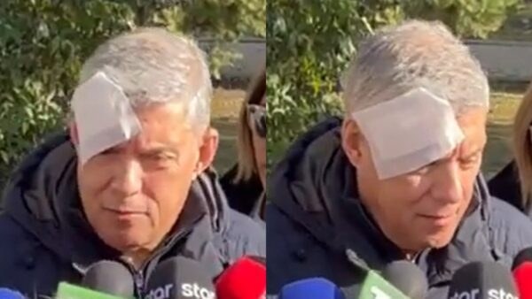 Ο Κώστας Αγοραστός χτυπημένος
