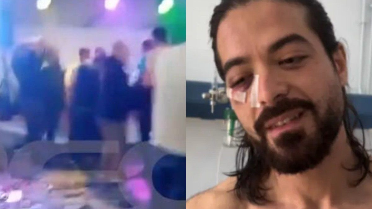 Ο Άρης Μουγκοπέτρος μετά το ατύχημα με την κροτίδα