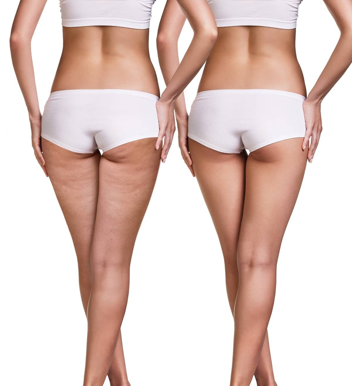 medi cosmetic reshaper πρόσωπο και σώμα