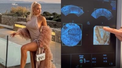 Η Ιωάννα Τούνη στον γυναικολόγο