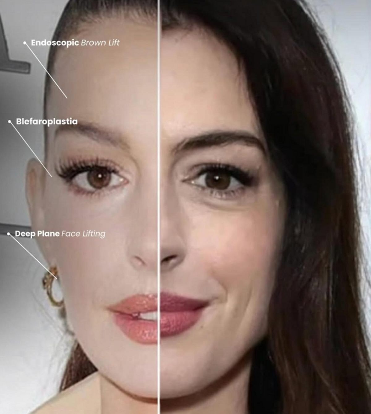 anne hathaway