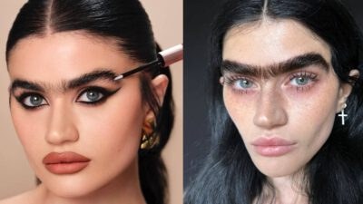 ozempic face σοφία χατζηπαντελή
