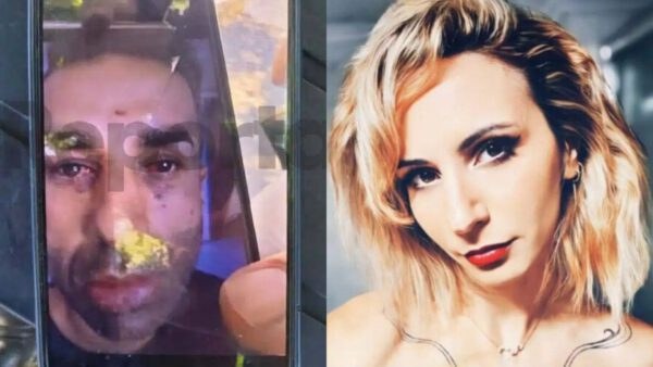 Οι αμυχές στο πρόσωπο του δολοφόνου στην Καλαμάτα
