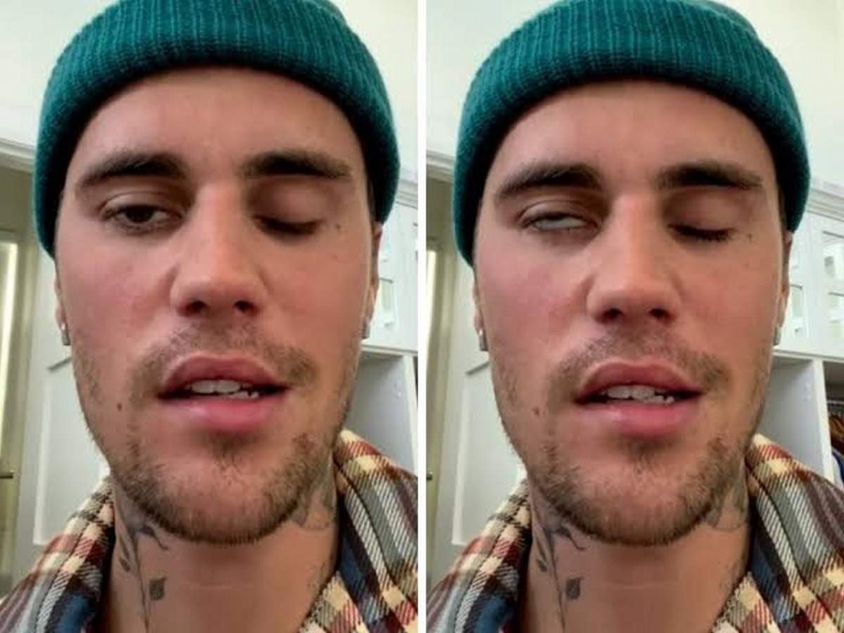 Justin Bieber θέμα υγείας με μάτια