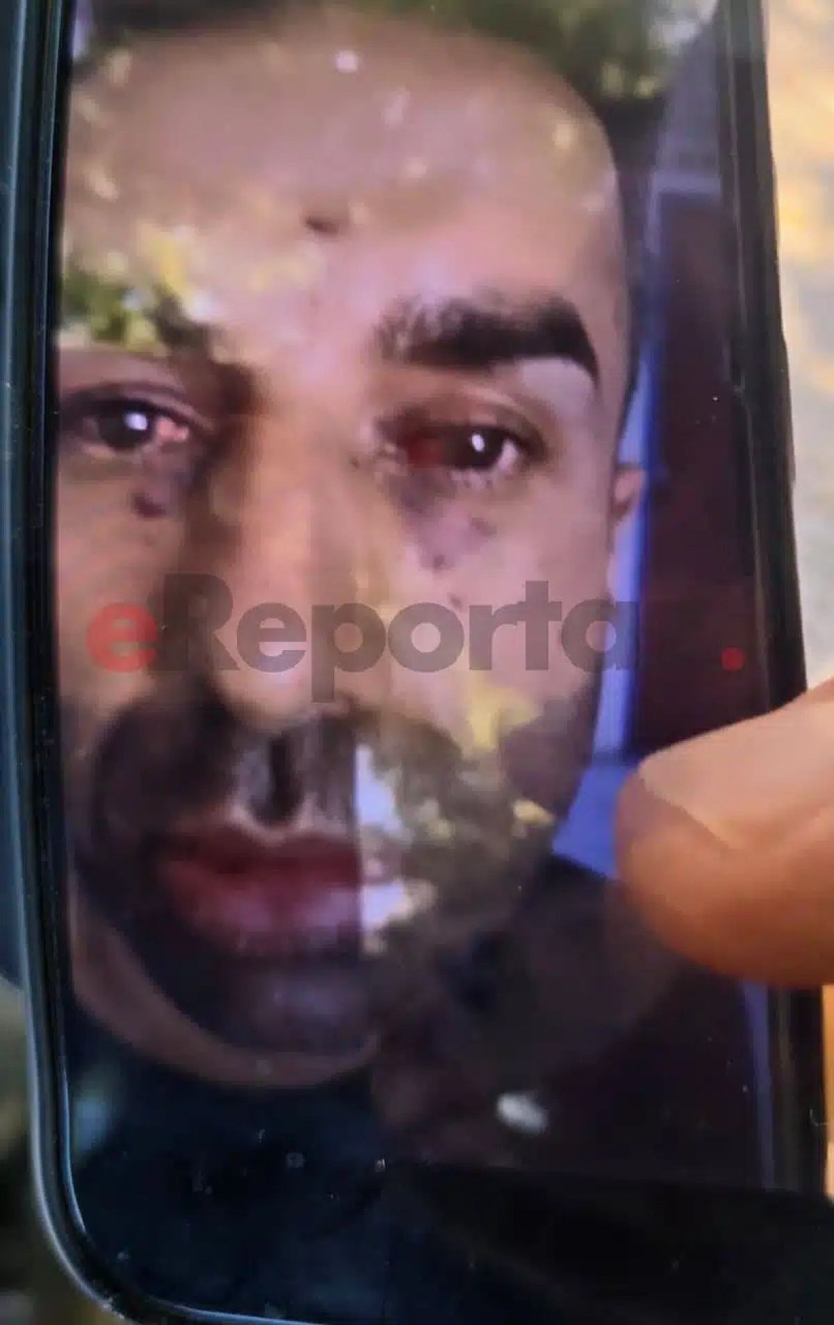 Οι αμυχές στο πρόσωπο του δολοφόνου στην Καλαμάτα