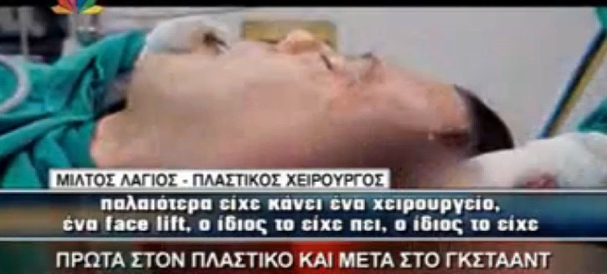 Ηλίας Ψινάκης: Ξαναμπαίνει στο χειρουργείο για λίφτινγκ - Η φωτογραφία με τα αίματα και τους μώλωπες που σόκαρε το Πανελλήνιο!