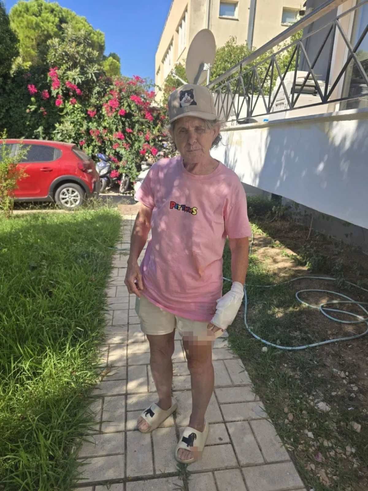 Θύμα επίθεσης σκύλων