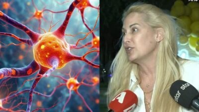 σκλήρυνσης κατά πλάκας