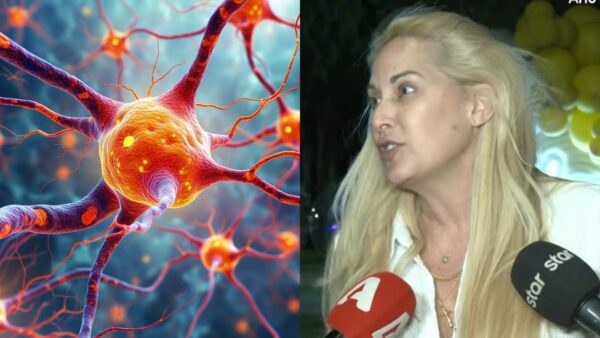 σκλήρυνσης κατά πλάκας